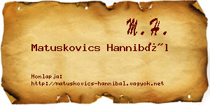 Matuskovics Hannibál névjegykártya